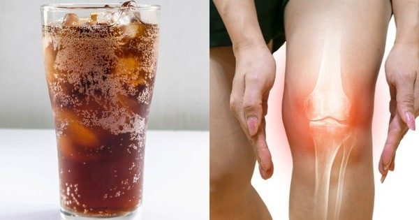 5 nhóm thực phẩm làm suy yếu hệ xương khớp nên tránh